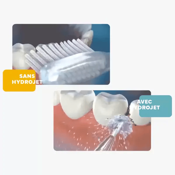Comparaison sans hydrojet